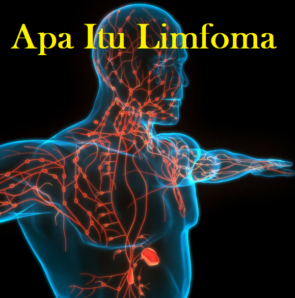 apa itu limfoma