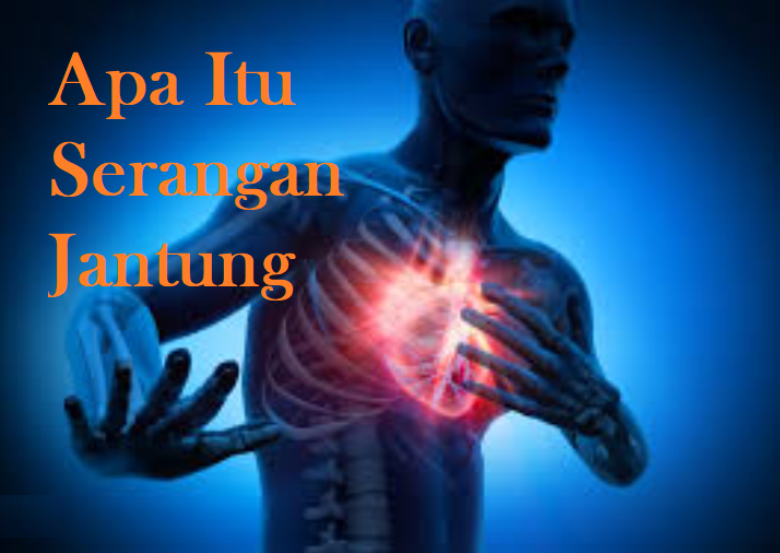 apa itu serangan jantung