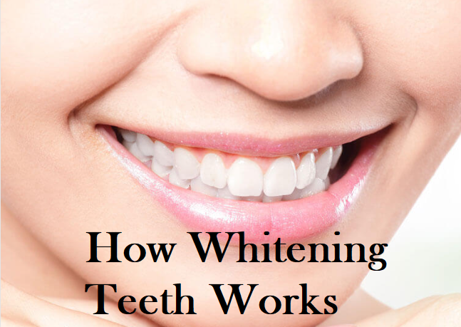 cara kerja pemutih gigi